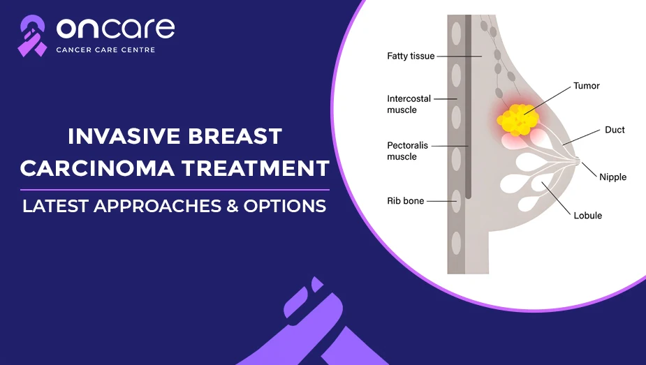 Invasive Breast Carcinoma Treatment: Latest Approaches and Options