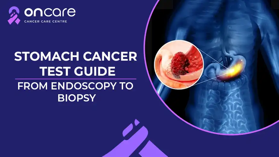 Stomach Cancer Test: Full Guide to Endoscopy, Biopsy and Early Detection