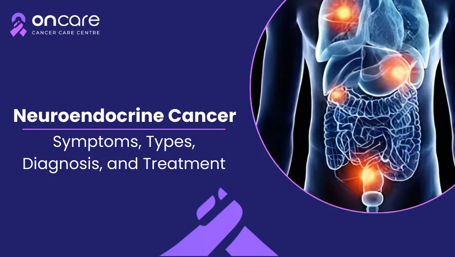 Everything you need to know about Neuroendocrine cancer