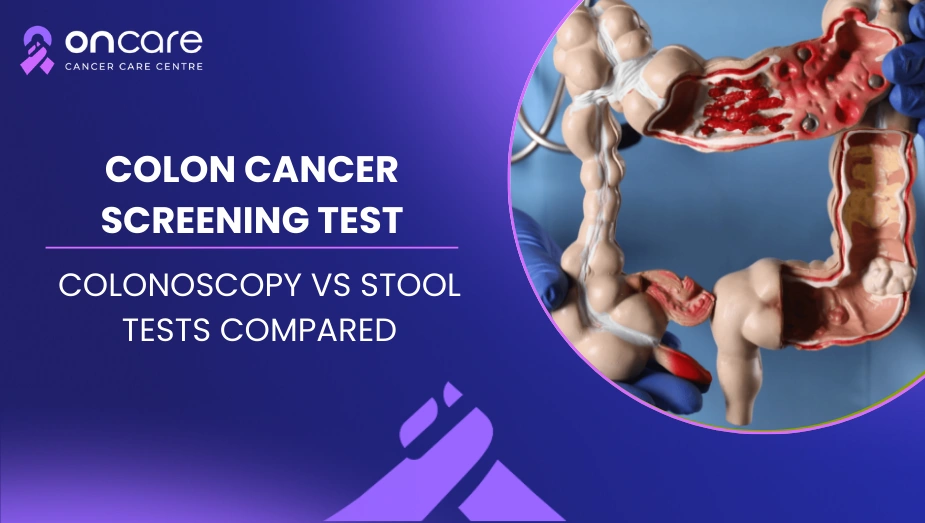 Get Colon Cancer Screening Today | Oncare Cancer Hospital