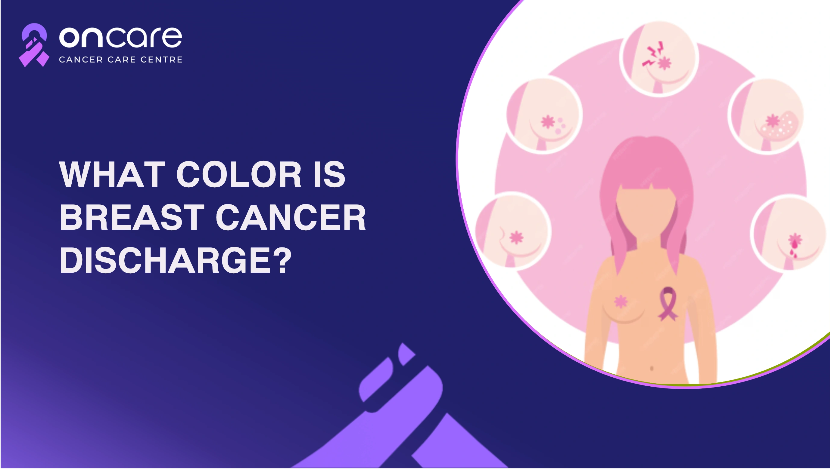 What Color Is Breast Cancer Discharge? Signs You Should Not Ignore
