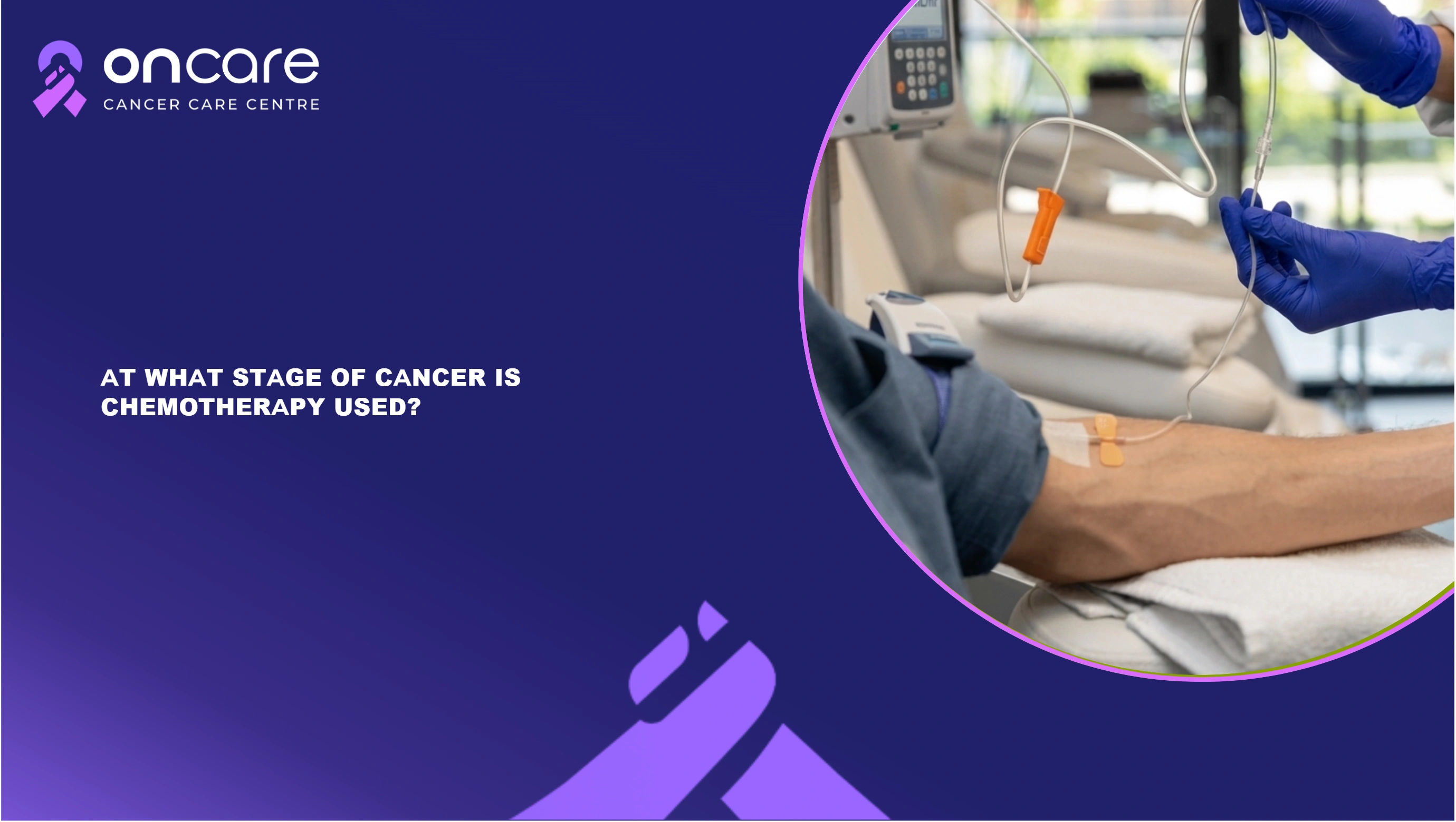 Chemotherapy Used at Which Cancer Stage? | Oncare