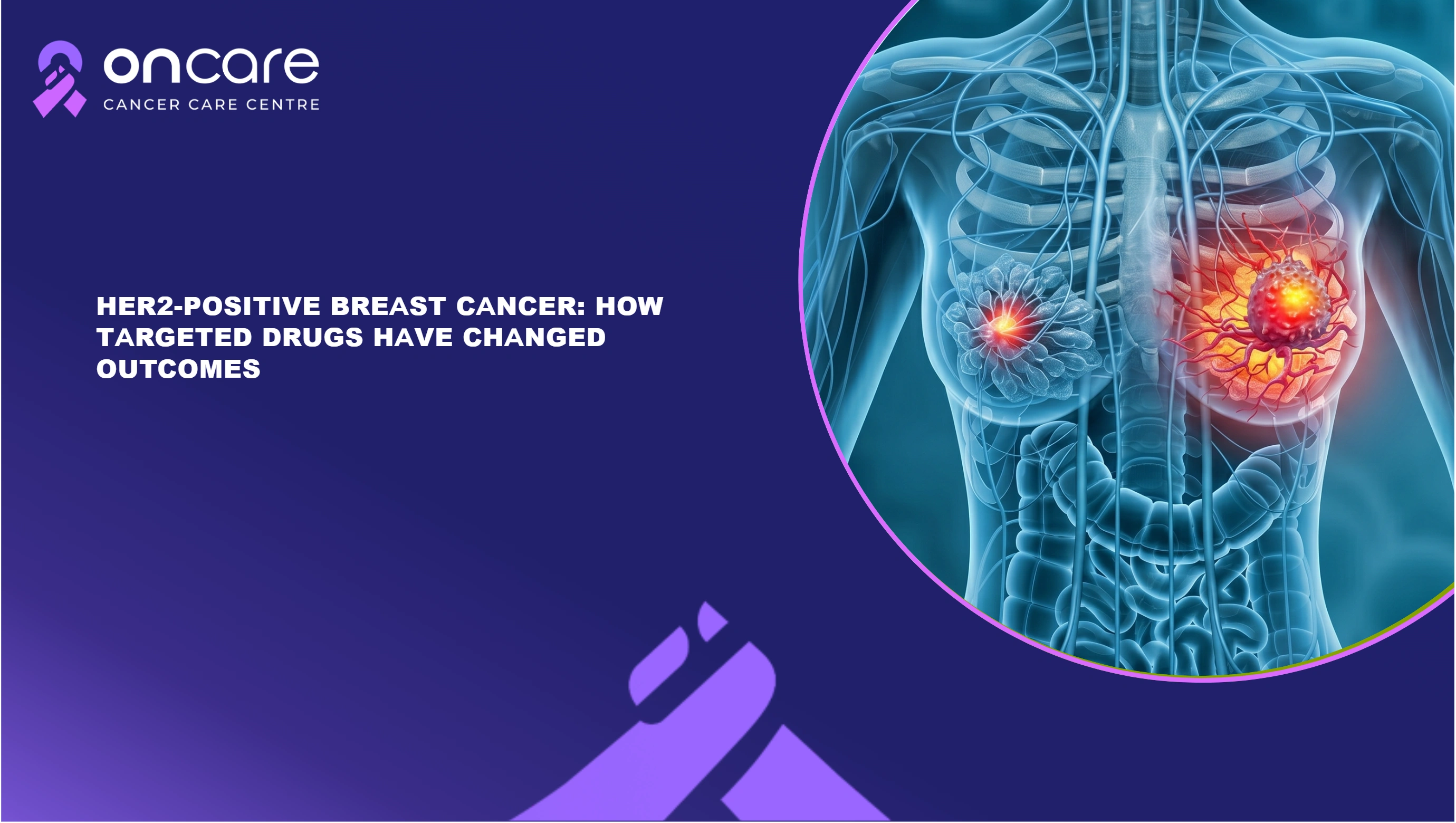 HER2-Positive Breast Cancer Treatment in India | Oncare
