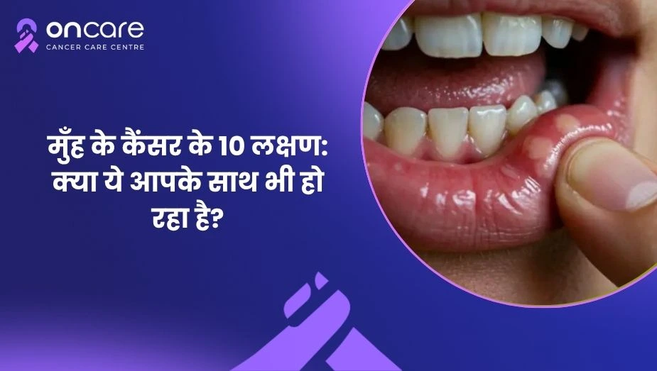  मुँह के कैंसर के 10 लक्षण | Oncare Cancer Hospital
