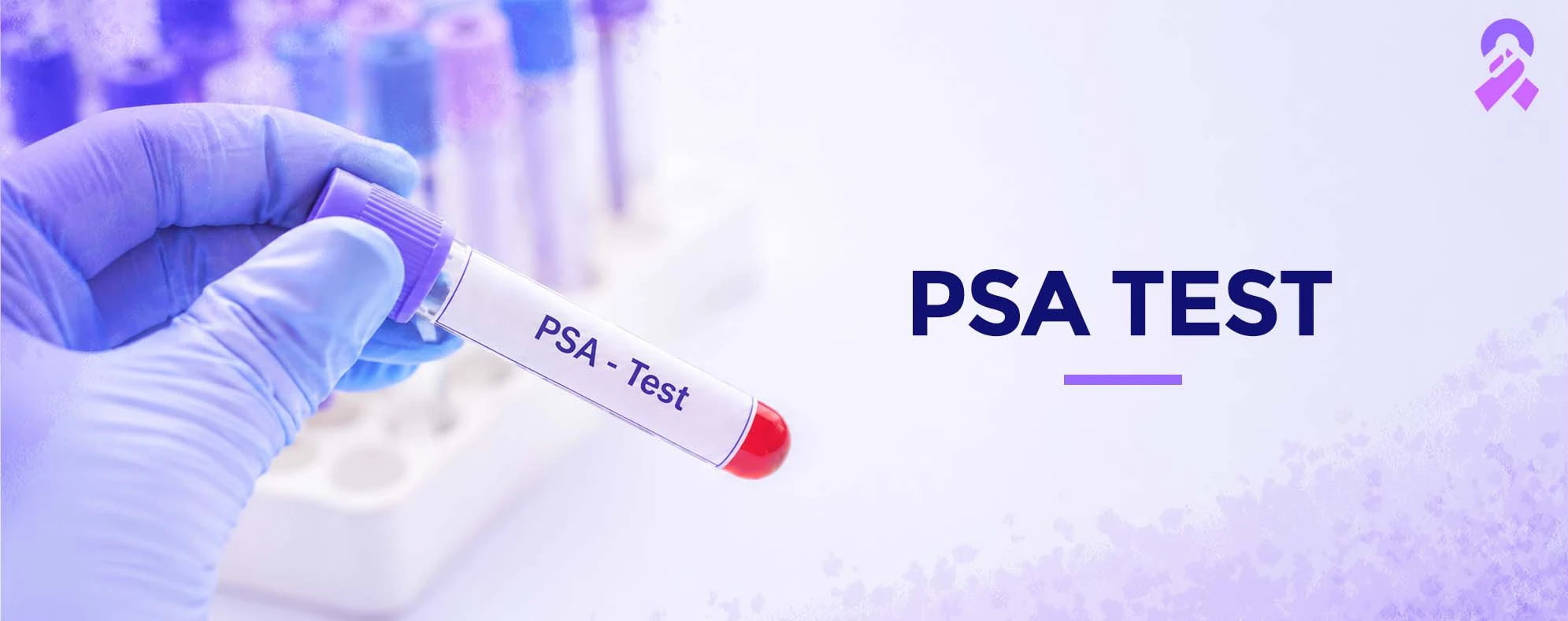 PSA Test for Prostate Cancer Screening | Oncare Cancer Hospital