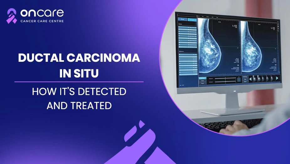  What is DCIS (Stage 0 Breast Cancer)? | Oncare Cancer Hospital