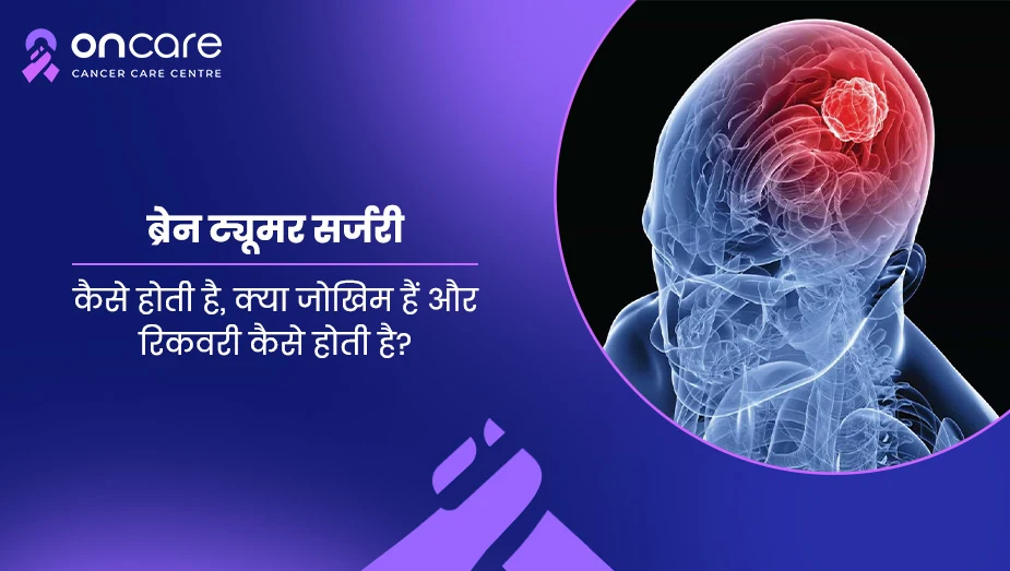 ब्रेन ट्यूमर सर्जरी क्या है? प्रक्रिया, जोखिम और रिकवरी की पूरी जानकारी