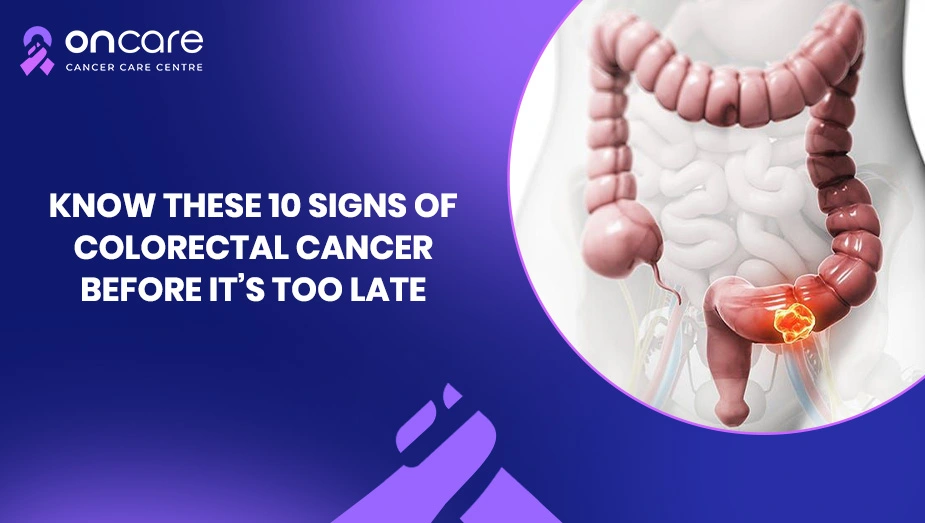 10 Early Signs of Colorectal Cancer You Shouldn’t Ignore | Oncare