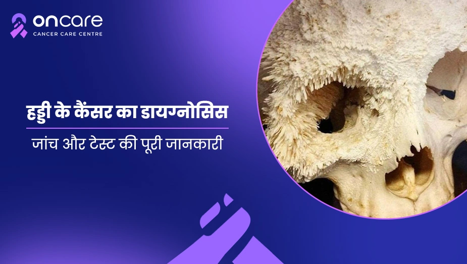 हड्डी के कैंसर का डायग्नोसिस | Oncare Cancer Hospital 