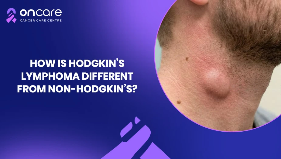 Hodgkin vs Non-Hodgkin Lymphoma | Oncare Cancer Hospital
