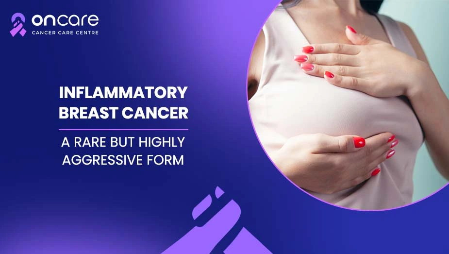 Inflammatory Breast Cancer Symptoms | Oncare Cancer Hospital