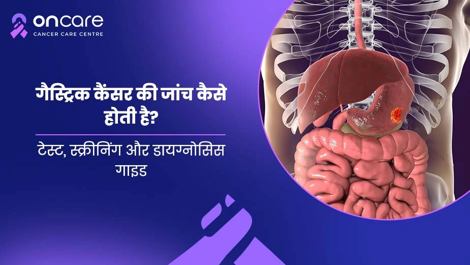 गैस्ट्रिक कैंसर की जांच कैसे होती है? | Oncare Cancer Hospital