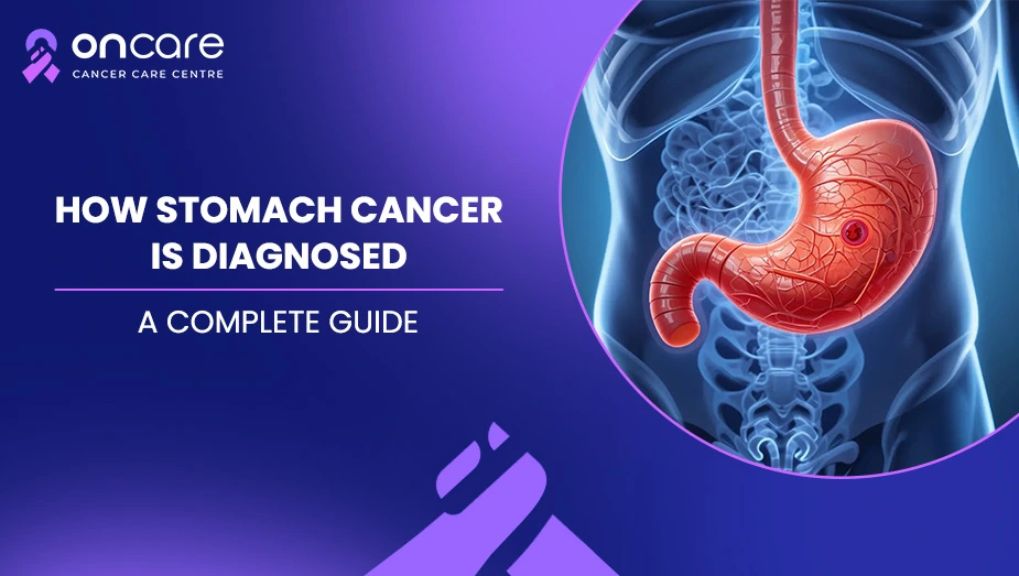 How Stomach Cancer Is Diagnosed | Oncare Cancer Hospital
