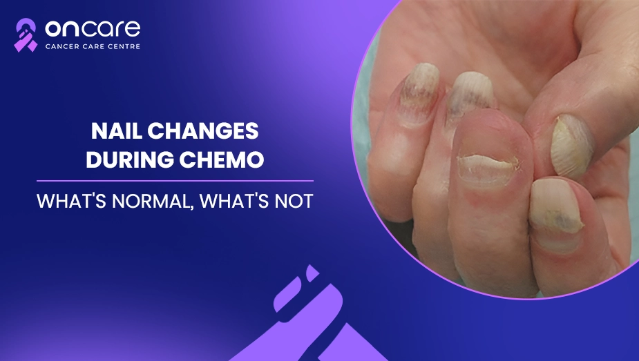 nail changes during chemo