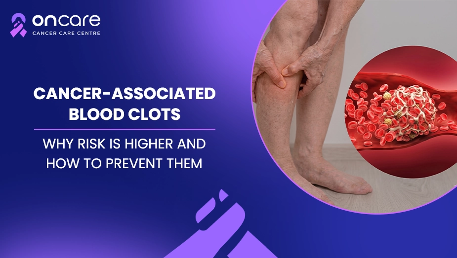 cancer related blood clots