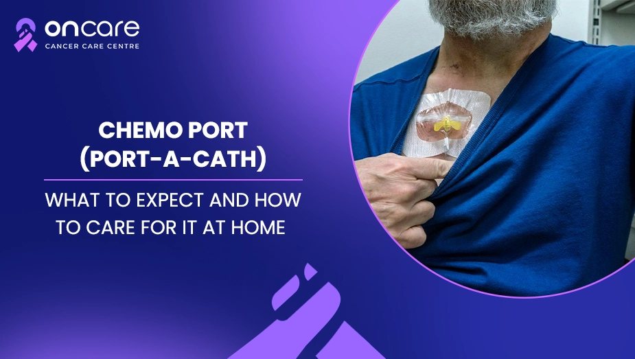 chemo port care