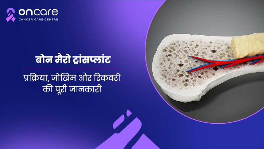 बोन मैरो ट्रांसप्लांट