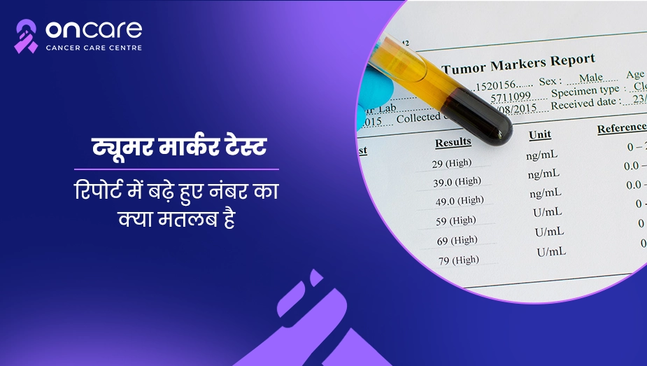 ट्यूमर मार्कर टेस्ट