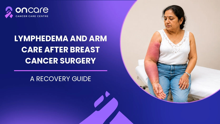 Lymphedema and Arm Care After Breast Cancer Surgery