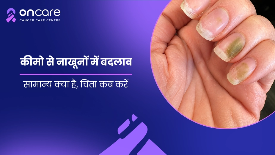 कीमोथेरेपी के दौरान नाखूनों में बदलाव