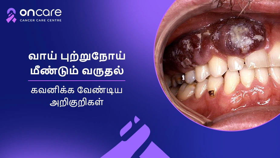 வாய் புற்றுநோய் மீண்டும் வருதல்