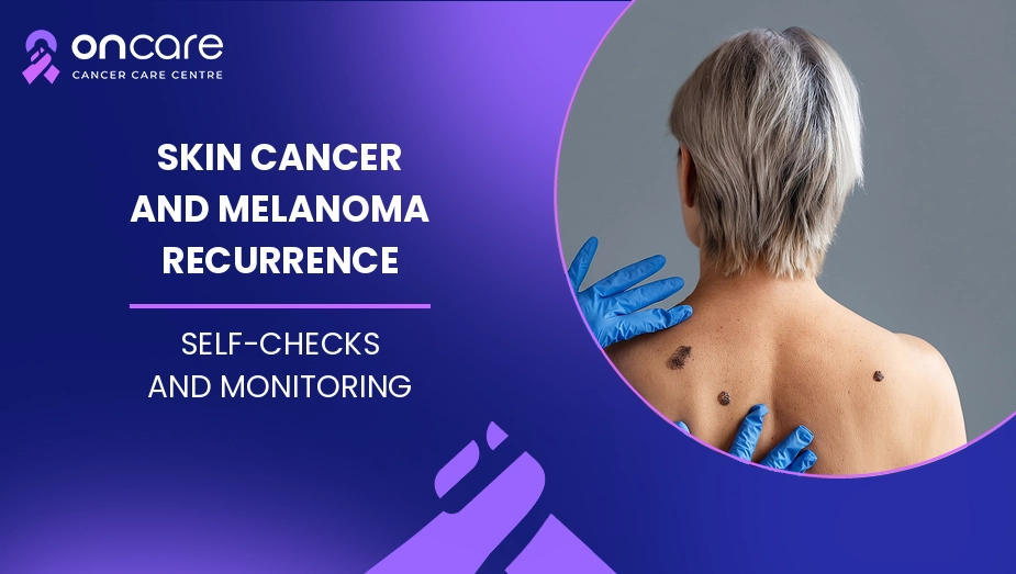 Skin Cancer and Melanoma Recurrence