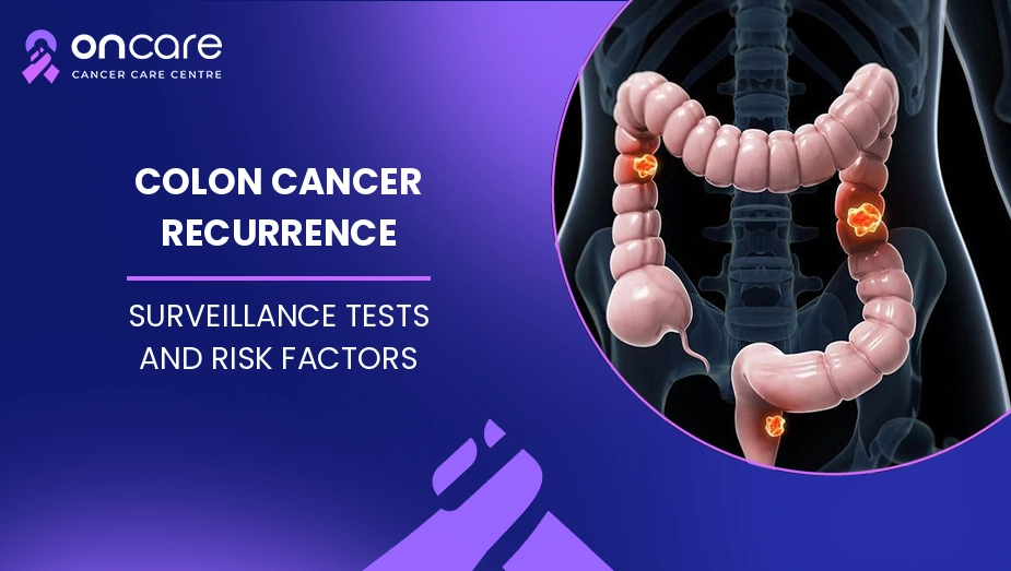Colon Cancer Recurrence