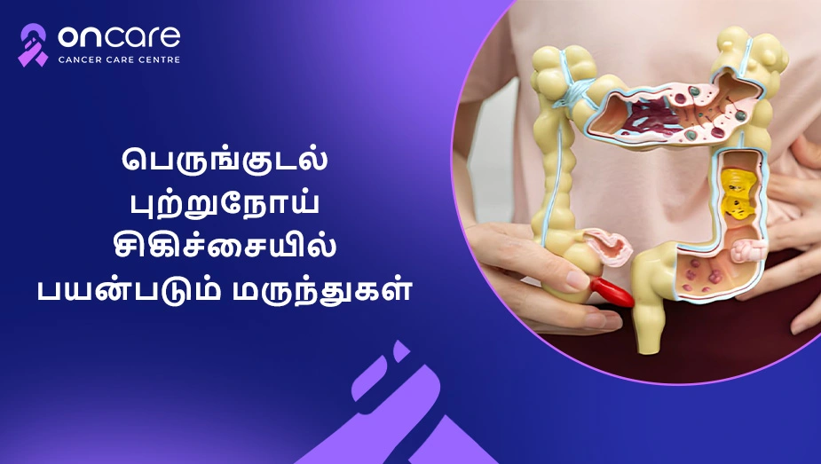 பெருங்குடல் புற்றுநோய் சிகிச்சை மருந்துகள் | Oncare Hospital
