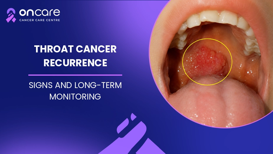 Throat Cancer Recurrence