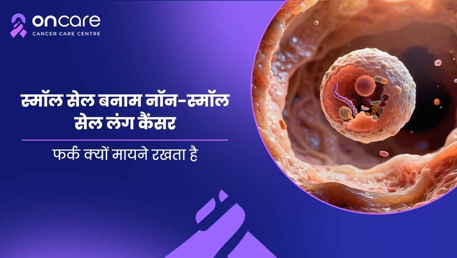 स्मॉल सेल बनाम नॉन-स्मॉल सेल लंग कैंसर | Oncare Cancer Hospital