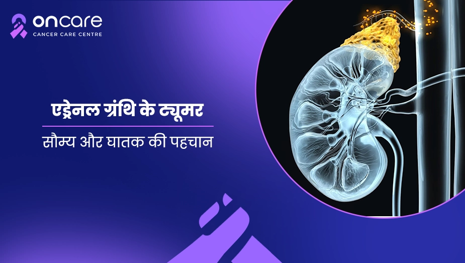 एड्रेनल ग्रंथि के ट्यूमर की पहचान | Oncare Cancer Hospital