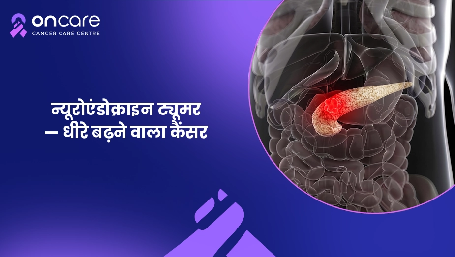 न्यूरोएंडोक्राइन ट्यूमर