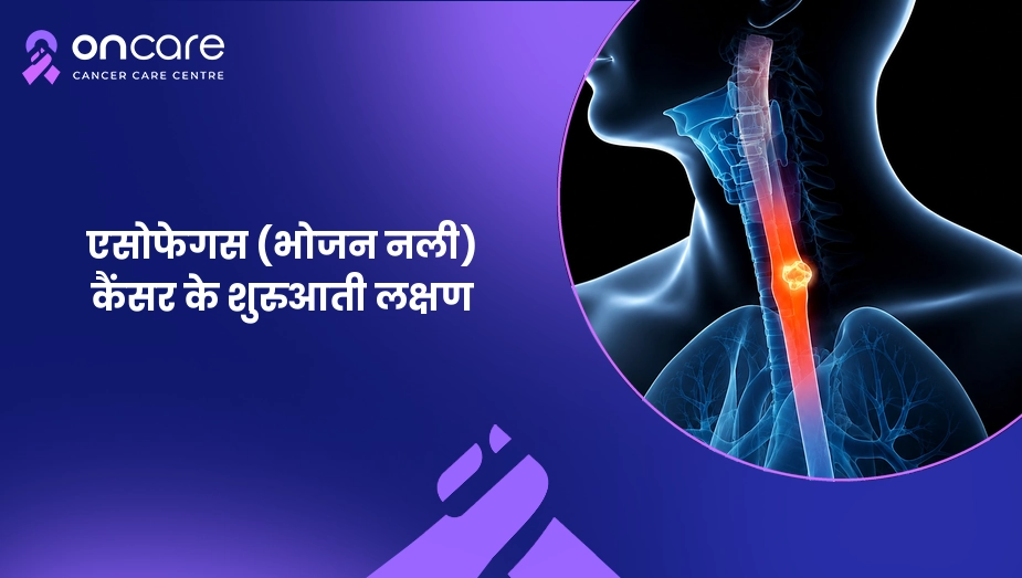 एसोफेगस कैंसर के शुरुआती लक्षण और जांच | Oncare Cancer Hospital