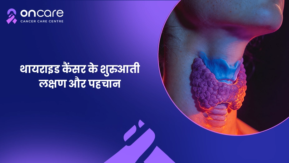 थायरॉइड कैंसर के शुरुआती लक्षण और इलाज | Oncare Cancer Hospital