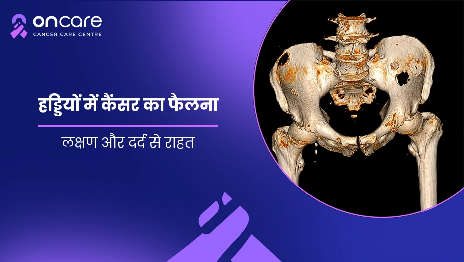 हड्डियों में कैंसर का फैलना