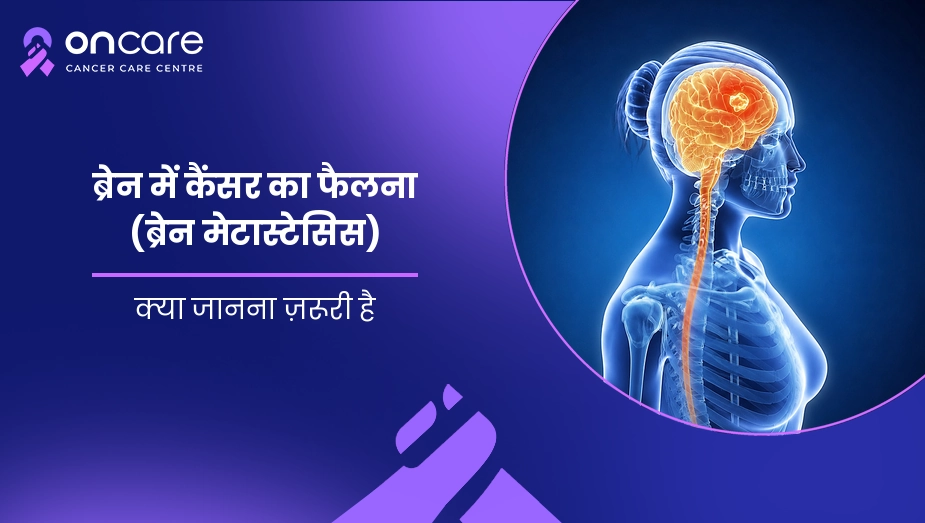 ब्रेन में कैंसर का फैलना