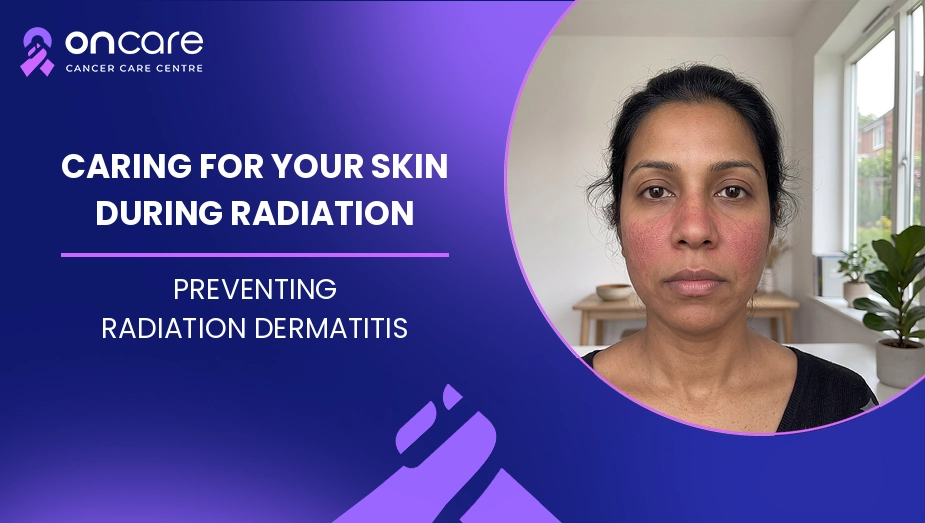 Caring for Your Skin During Radiation