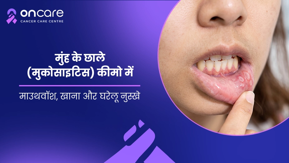 मुंह के छाले (मुकोसाइटिस) कीमो में