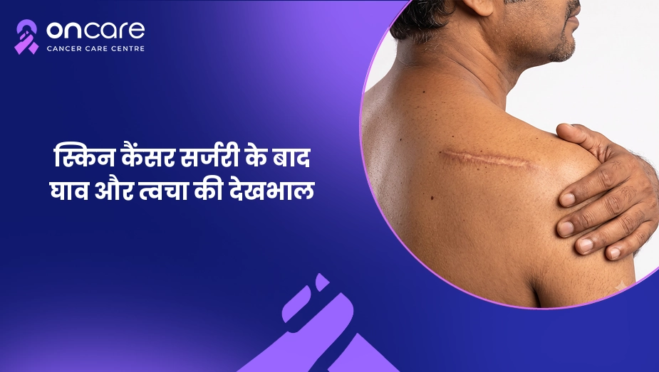 स्किन कैंसर सर्जरी