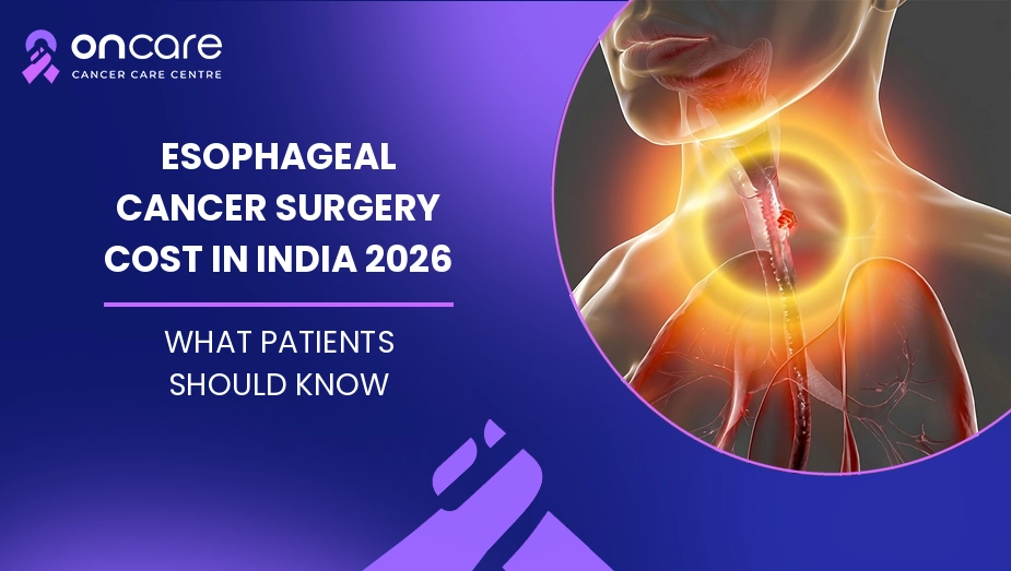 Esophageal Cancer Surgery Cost