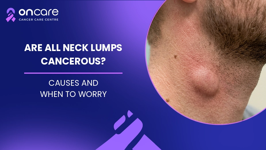 Are All Neck Lumps Cancerous?