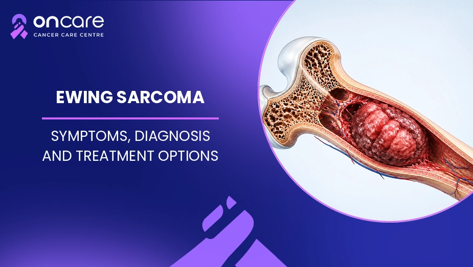 Ewing Sarcoma