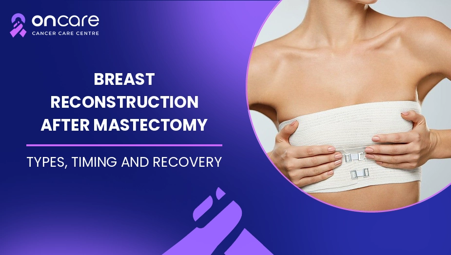 Breast Reconstruction After Mastectomy