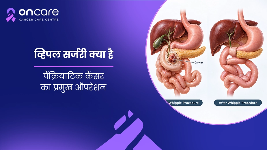 व्हिपल सर्जरी क्या है