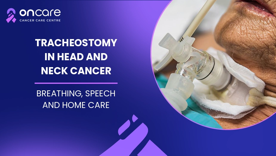 Tracheostomy in Head and Neck Cancer
