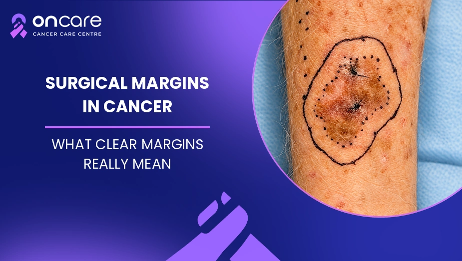 Surgical Margins in Cancer