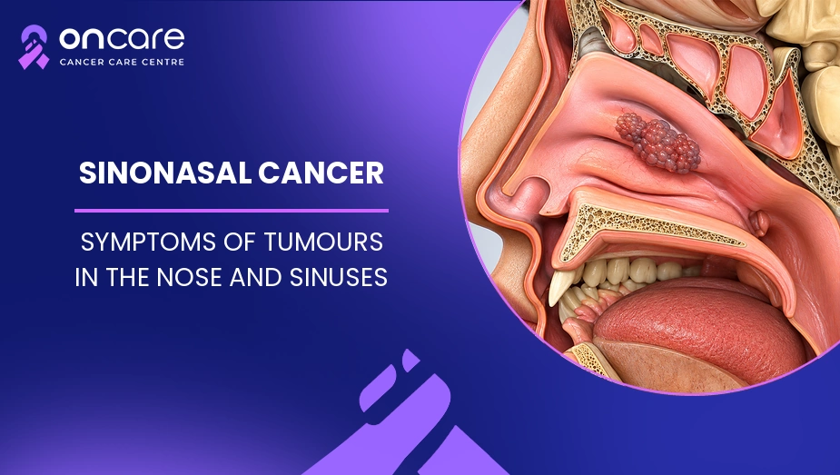 Sinonasal Cancer