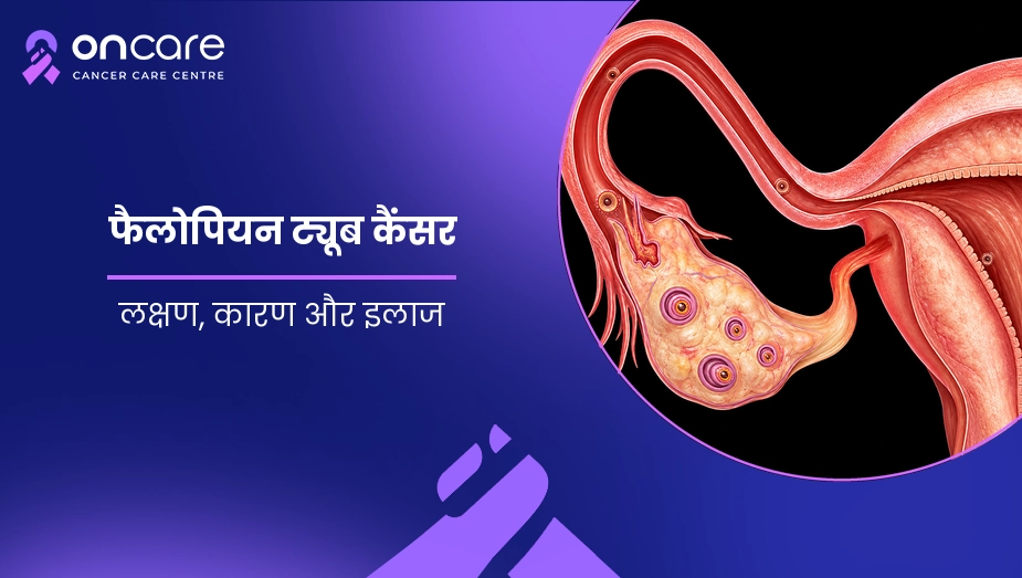 फैलोपियन ट्यूब कैंसर
