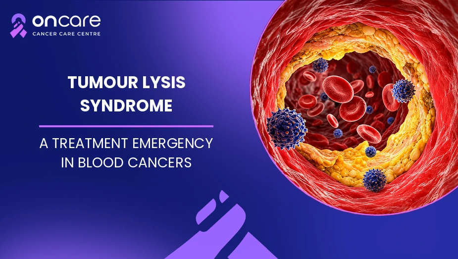 Tumour Lysis Syndrome