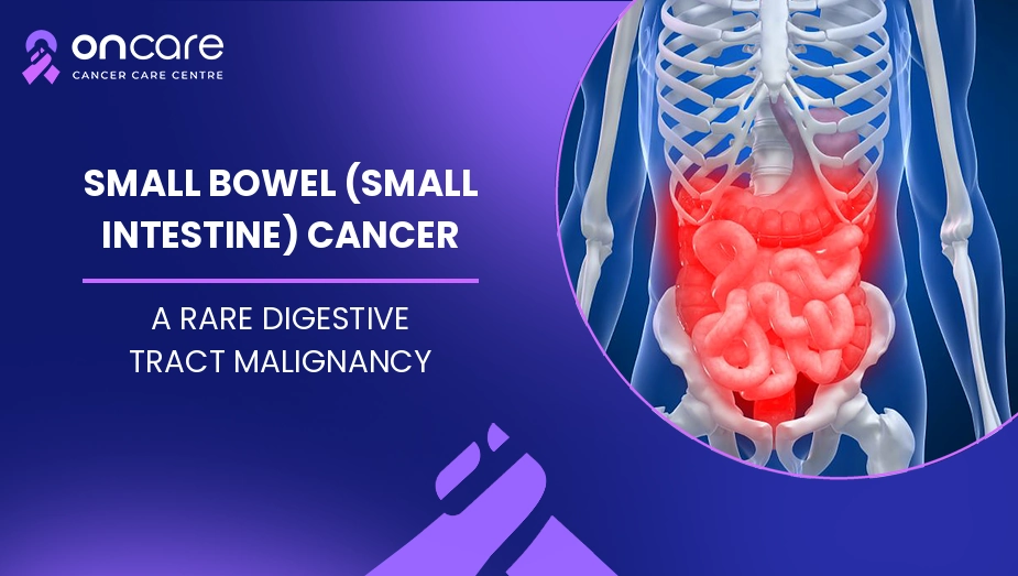 small intestine cancer